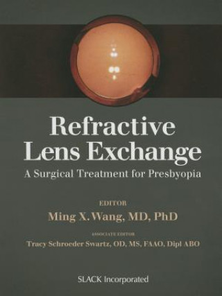 Refractive Lens Exchange