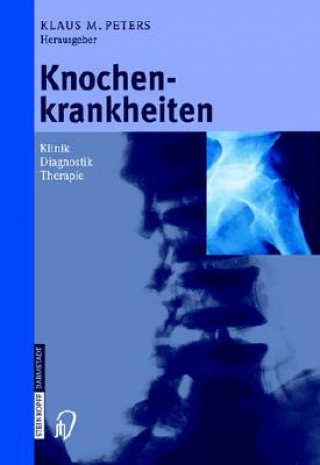 Knochenkrankheiten