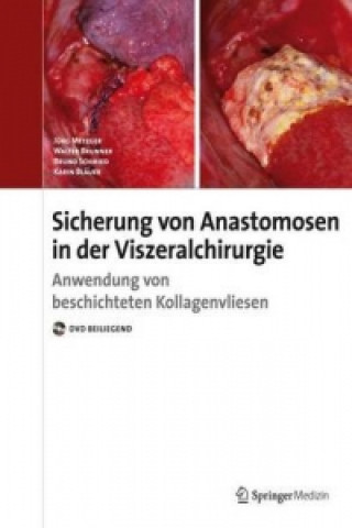 Anastomosensicherung in der Visceralchirurgie