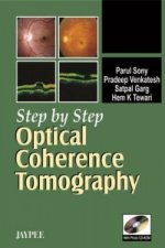 Step by Step: Optical Coherence Tomography