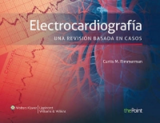 Electrocardiografia. Una revision basada en casos