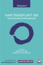 Hair Transplant 360: Volume 4