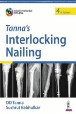 Tanna's Interlocking Nailing