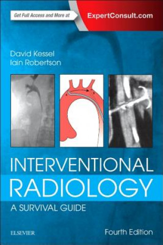 Interventional Radiology: A Survival Guide