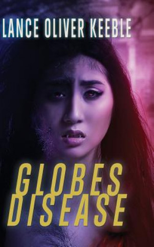 Globes Disease