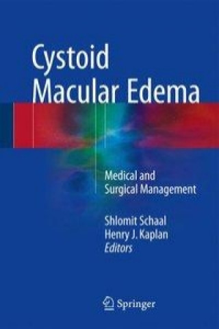 Cystoid Macular Edema