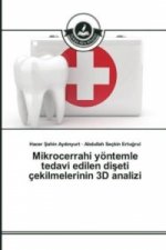 Mikrocerrahi yöntemle tedavi edilen diseti çekilmelerinin 3D analizi
