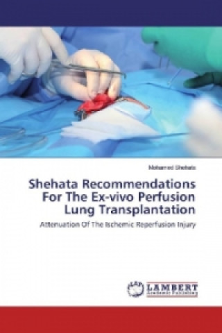 Shehata Recommendations For The Ex-vivo Perfusion Lung Transplantation