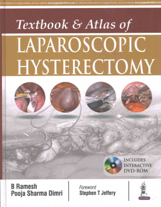 Textbook & Atlas of Laparoscopic Hysterectomy (Without DVD-ROOM)