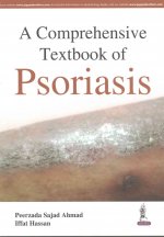 Comprehensive Textbook of Psoriasis