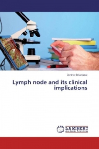Lymph node and its clinical implications