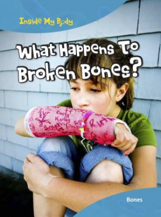 What Happens to Broken Bones?