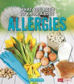 What You Need to Know About Allergies