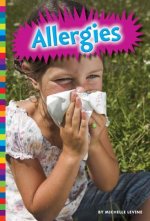 Allergies