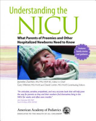 Understanding the Nicu