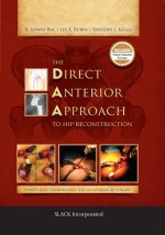 Direct Anterior Approach to Hip Reconstruction