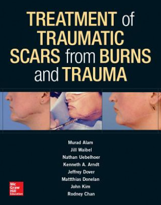 Treatment of Scars from Burns and Trauma