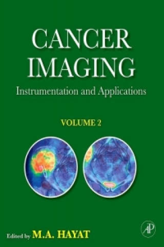 Cancer Imaging: Volume 2