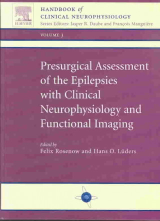 Presurgical Assessment of the Epilepsies with Clinical Neurophysiology and Functional Imaging: Handbook of Clinical Neurophysiology Series, Volume 3