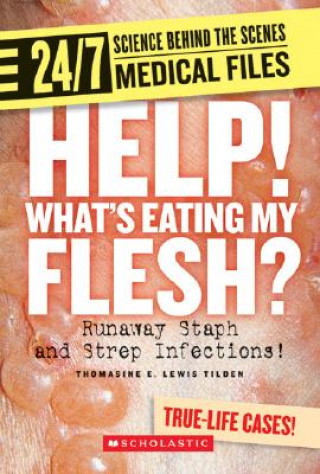 Help! Whats Eating My Flesh?: Runaway Staph and Strep Infections!
