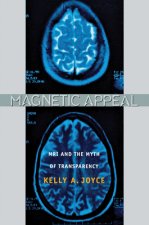 Magnetic Appeal: MRI and the Myth of Transparency