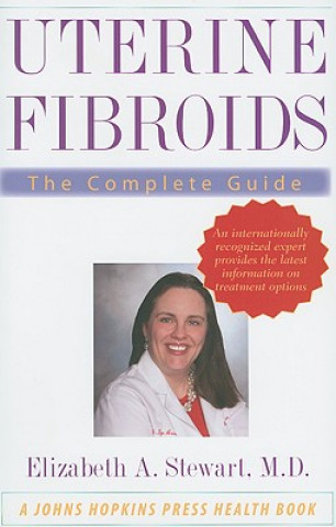 Uterine Fibroids: The Complete Guide