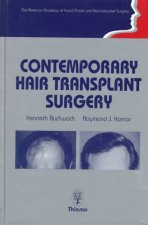 Contemporary Hair Transplant Surgery: