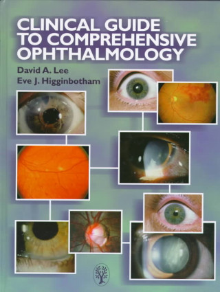 Clinical Guide to Comprehensive Ophthalmology