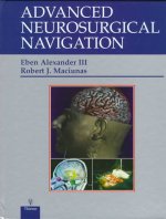 Advanced Neurosurgical Navigation