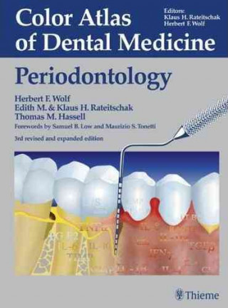 Color Atlas of Dental Medicine: Periodontology