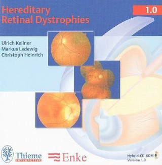 Hereditary Retinal Dystrophies
