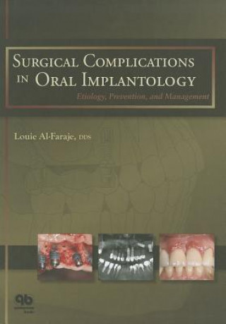 Surgical Complications in Oral Implantology: Etiology, Prevention, and Management