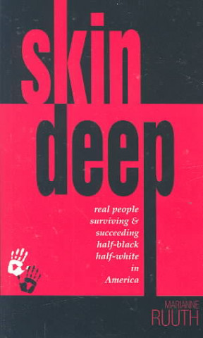 Skin Deep: Real People Surviving & Succeeding Half-Black Half-White in America