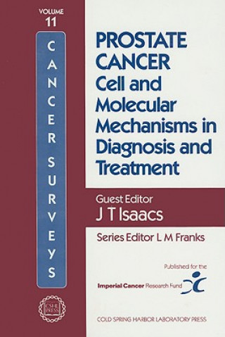 Prostate Cancer: Cell and Molecular Mechanisms in Diagnosis and Treatment