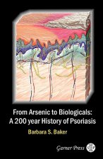 From Arsenic to Biologicals: A 200 Year History of Psoriasis