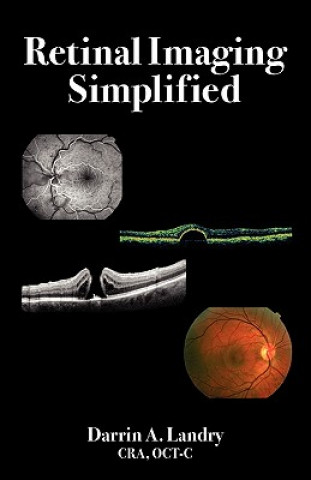 Retinal Imaging Simplified