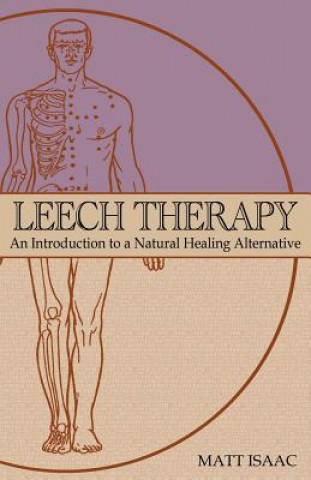 Leech Therapy: An Introduction to a Natural Healing Alternative