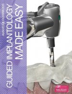 Guided Implantology Made Easy