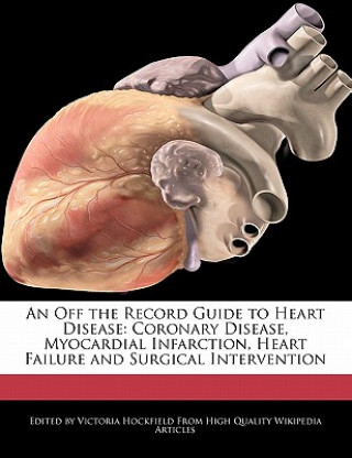 An Off the Record Guide to Heart Disease: Coronary Disease, Myocardial Infarction, Heart Failure and Surgical Intervention