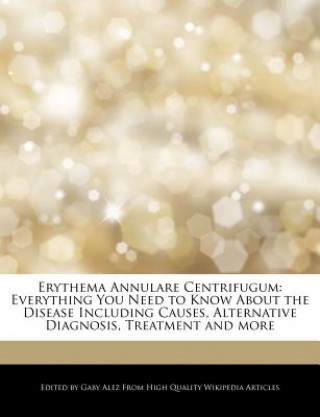 Erythema Annulare Centrifugum: Everything You Need to Know about the Disease Including Causes, Alternative Diagnosis, Treatment and More