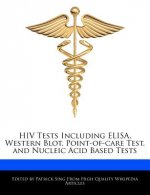 HIV Tests Including Elisa, Western Blot, Point-Of-Care Test, and Nucleic Acid Based Tests