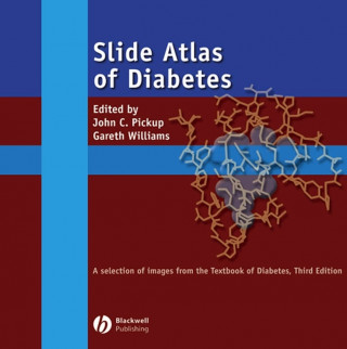 Slide Atlas of Diabetes, CD-ROM: A Selection of Images from the Textbook of Diabetes