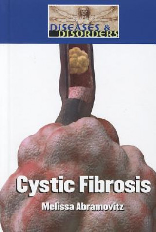 Cystic Fibrosis