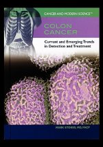 Colon Cancer: Current and Emerging Trends in Detection and Treatment