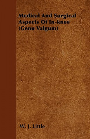 Medical And Surgical Aspects Of In-knee (Genu Valgum)