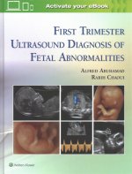 First Trimester Ultrasound Diagnosis of Fetal Abnormalities