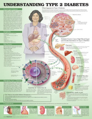 Understanding Type 2 Diabetes Anatomical Chart. Laminated