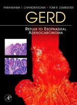 Gerd: Reflux to Esophageal Adenocarcinoma