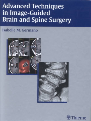 Advanced Techniques in Image-Guided Brain and Spine Surgery