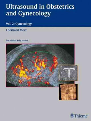 Ultrasound in Gynecology and Obstetrics, Vol. 2: Gynecology